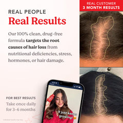 HAIRtamin capsule in hand demonstrates single daily dose convenience