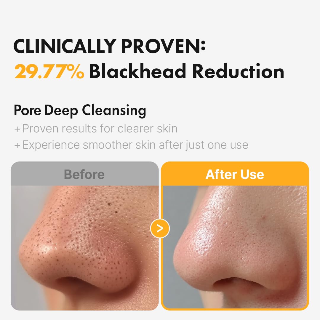 Hanskin spotlight on tea tree and aloe ingredients highlighting calming and clarifying benefits