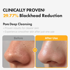Hanskin spotlight on tea tree and aloe ingredients highlighting calming and clarifying benefits
