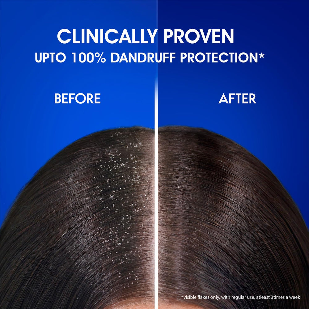 Head & Shoulders in‑shower use showing easy daily routine and refreshed benefit