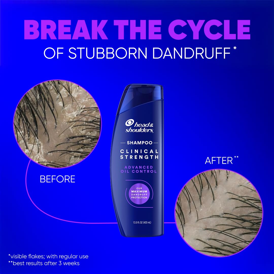 Head & Shoulders twin pack shown in hand for size and value