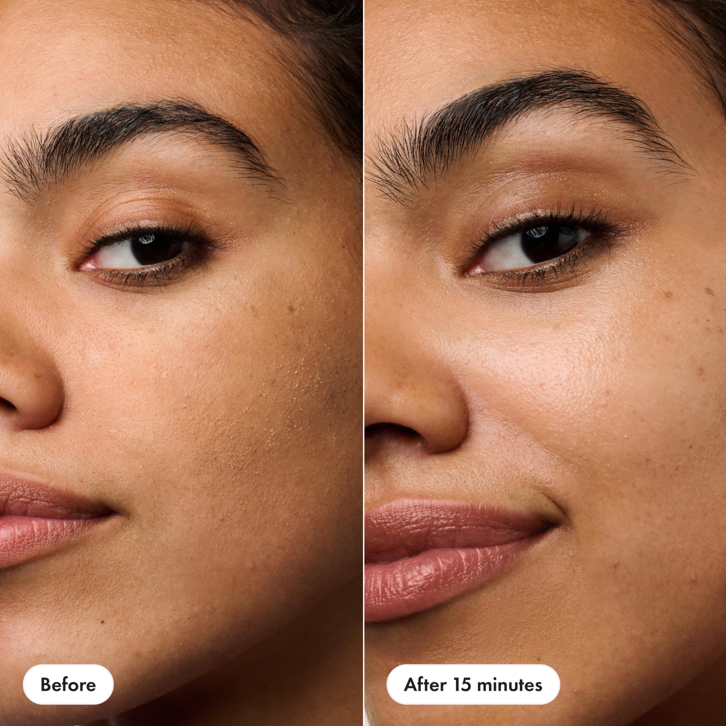 HERO COSMETICS patch applied on cheek showing secure facial fit