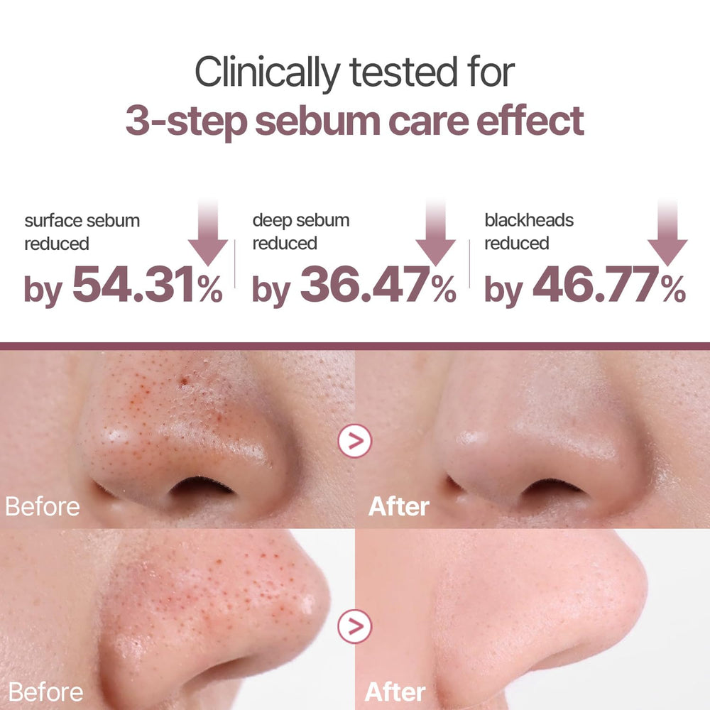 HEVEBLUE step two sebum mask texture detail for gentle absorption