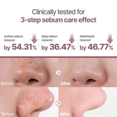 HEVEBLUE step two sebum mask texture detail for gentle absorption