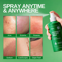 Honeydew Labs BIONA applied to fresh tattoo area to support aftercare