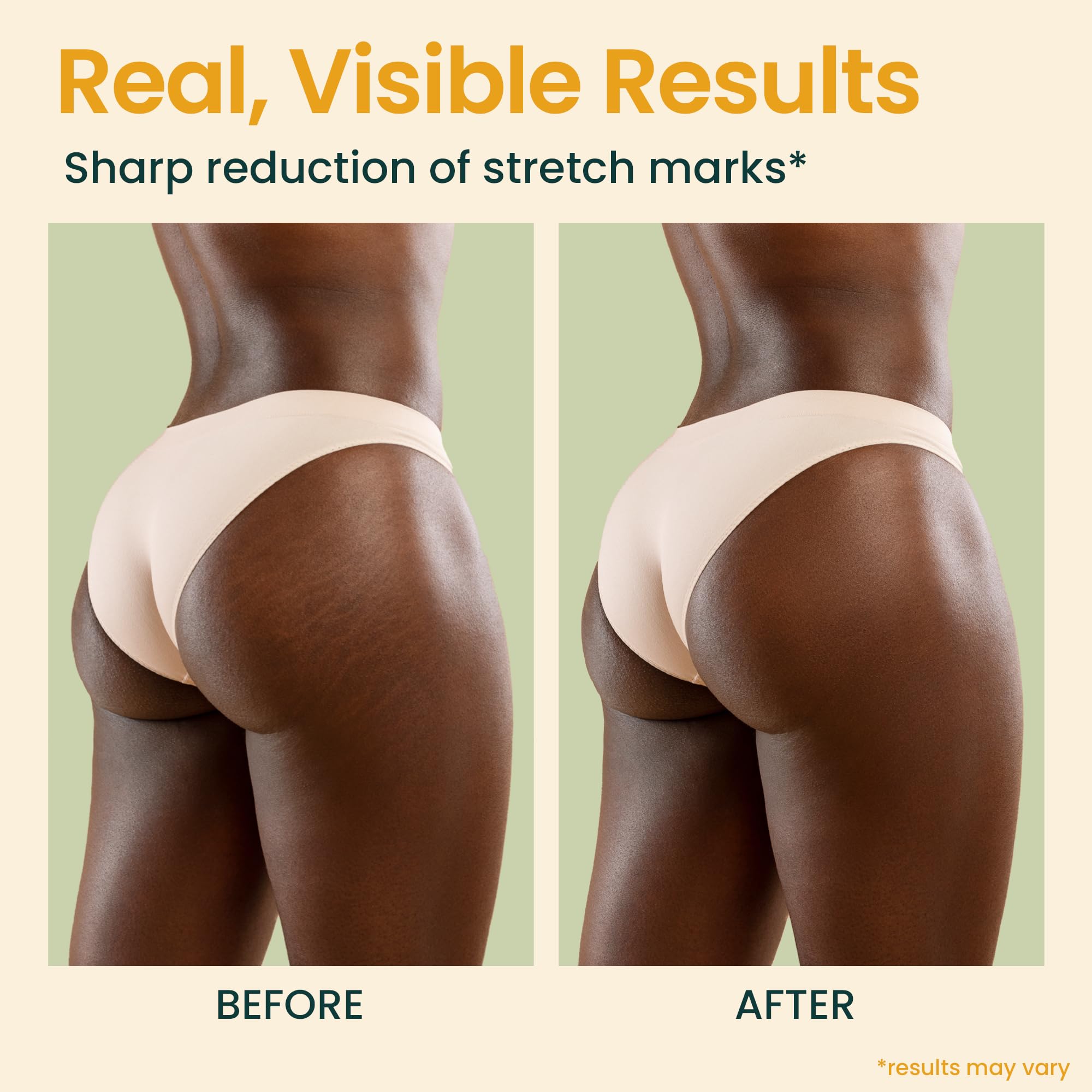 Honeyskin on expectant belly lifestyle image showing soothing hydration