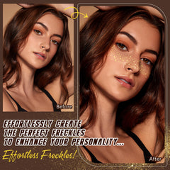 Close detail of HSEM freckles along the nose bridge emphasizing natural-looking sparkle