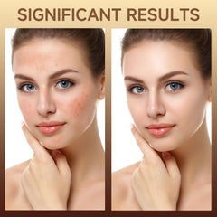 HZENPPOR label close-up highlighting ingredients like PDRN, hyaluronic acid, and niacinamide