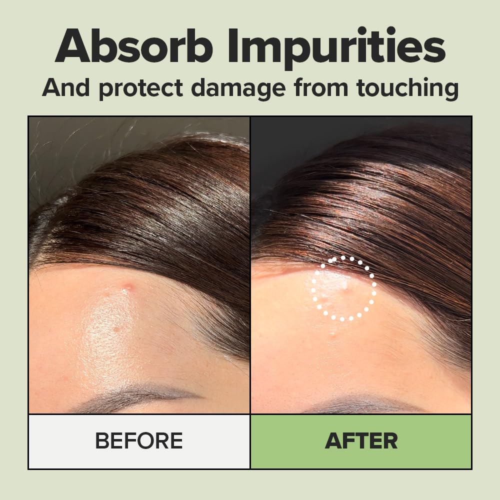 I DEW CARE patches in hand showing large size and easy spot treatment