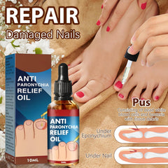 Iaolose being applied to toenail fold illustrating gentle relief