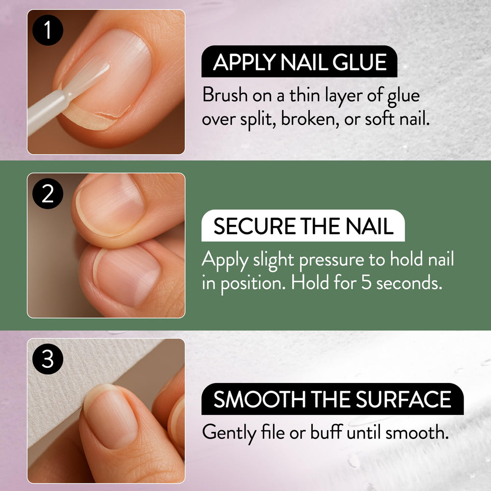 IBD nail repair before after comparison showing strengthened nail
