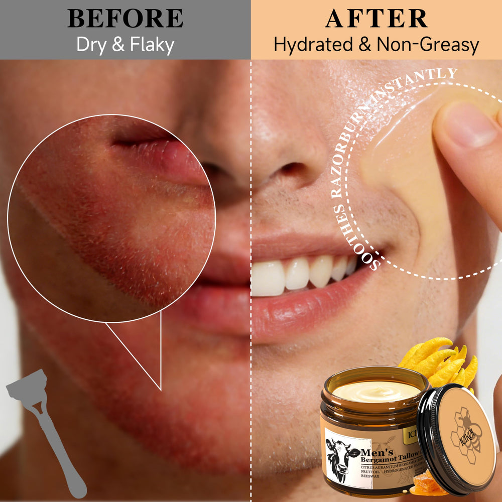 ICIKOL label close-up highlighting Manuka honey and bergamot scent benefit