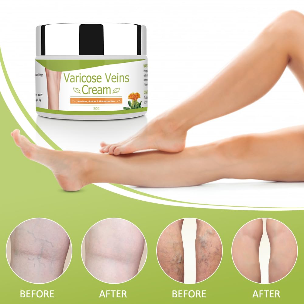 IDUCEN lifestyle scene of relaxed legs after use emphasizing comfort