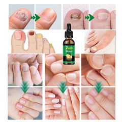 IMOLL dropper releasing oil illustrating texture and fast absorption benefit