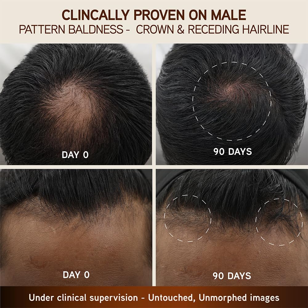 INDULEKHA scalp application demo illustrating massage benefit