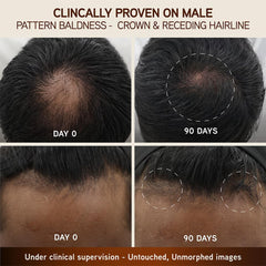 INDULEKHA scalp application demo illustrating massage benefit