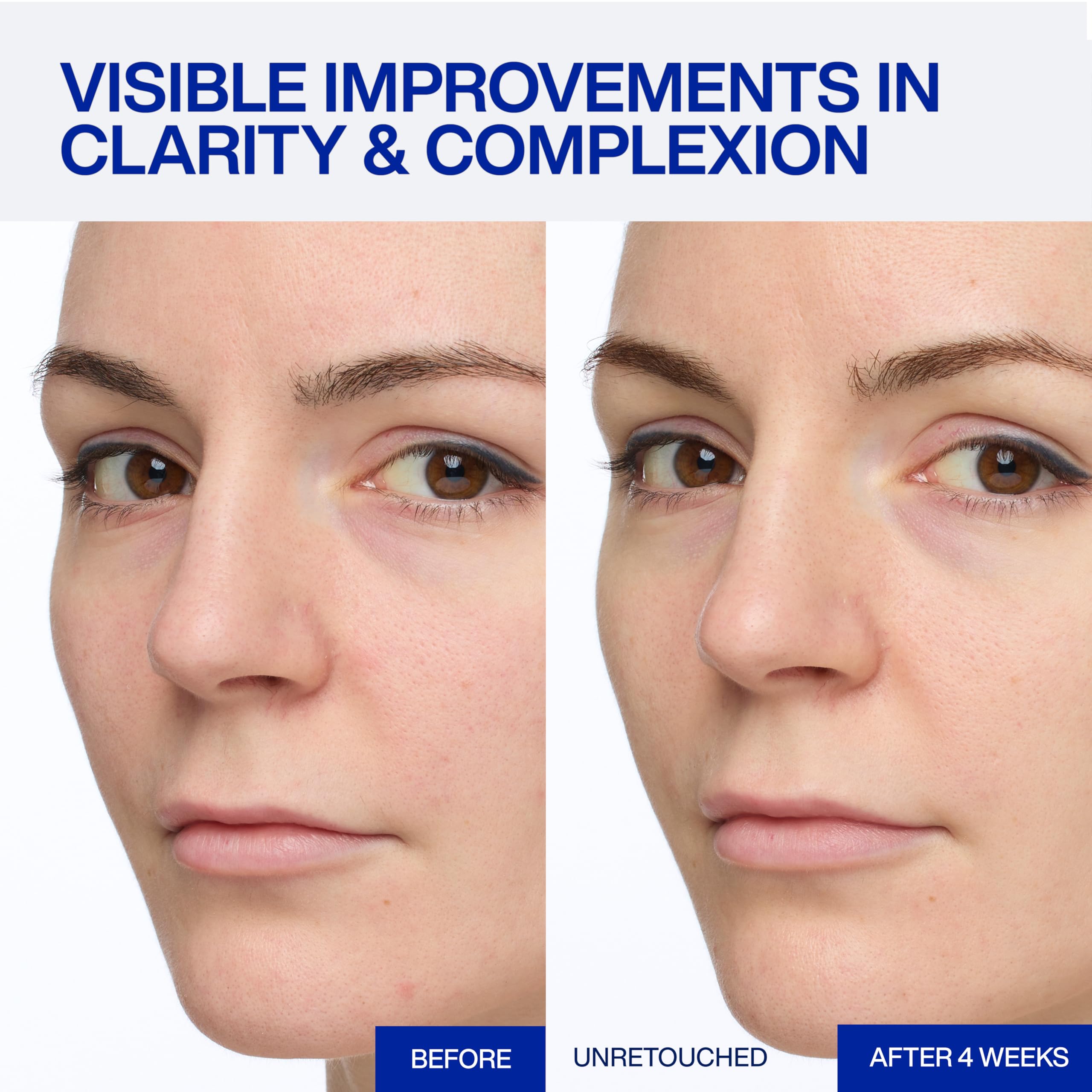 IOPE dropper releasing serum highlighting controlled, hygienic dosing