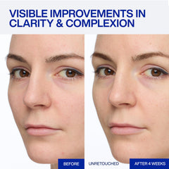 IOPE dropper releasing serum highlighting controlled, hygienic dosing