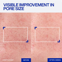 IOPE close-up of serum texture showing lightweight absorption benefit