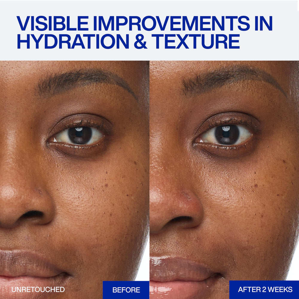 IOPE XMD Stem III ingredient focus on PDRN highlighting barrier-supporting benefit
