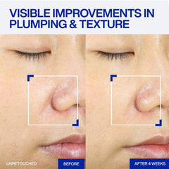 IOPE pump dispenser detail for precise clinical-level application