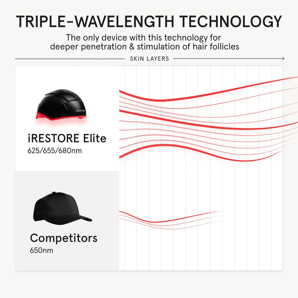 iRestore Elite diagram of crown and hairline coverage for maximum scalp reach