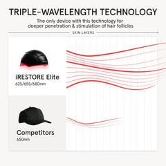 iRestore Elite diagram of crown and hairline coverage for maximum scalp reach