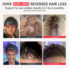 iRestore Elite close-up of lasers and LEDs for deeper follicle stimulation