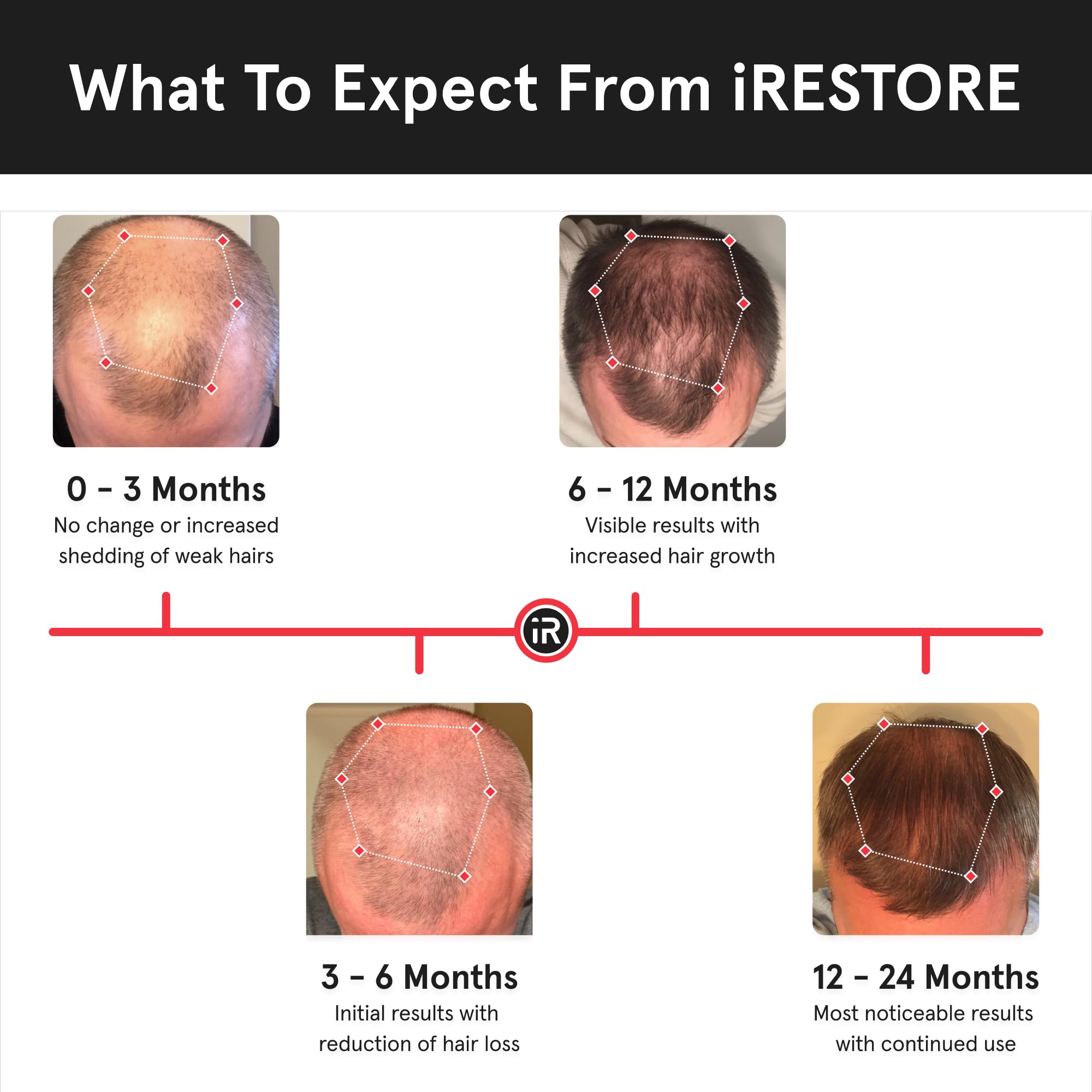 iRestore worn by model demonstrating hands-free convenience benefit