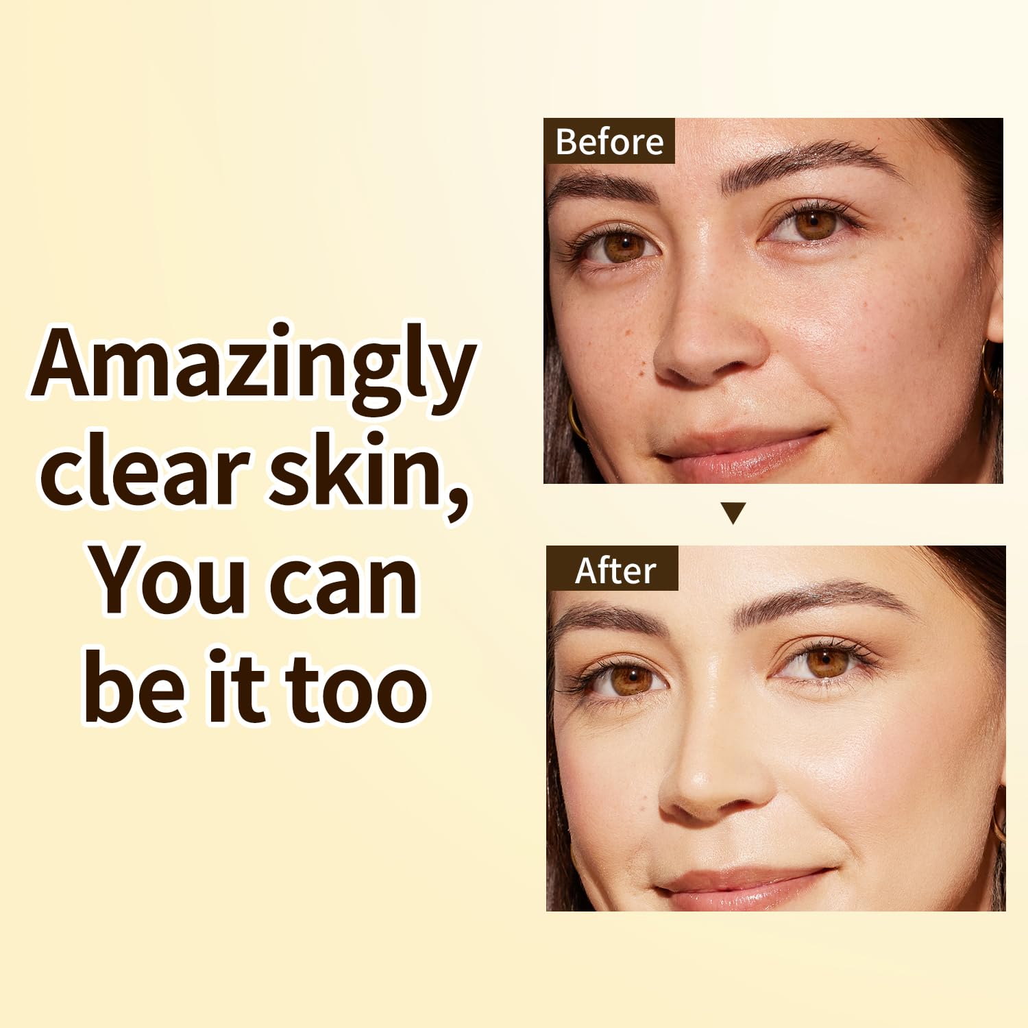 IREV dropper dispensing clear serum for precise application and minimal waste