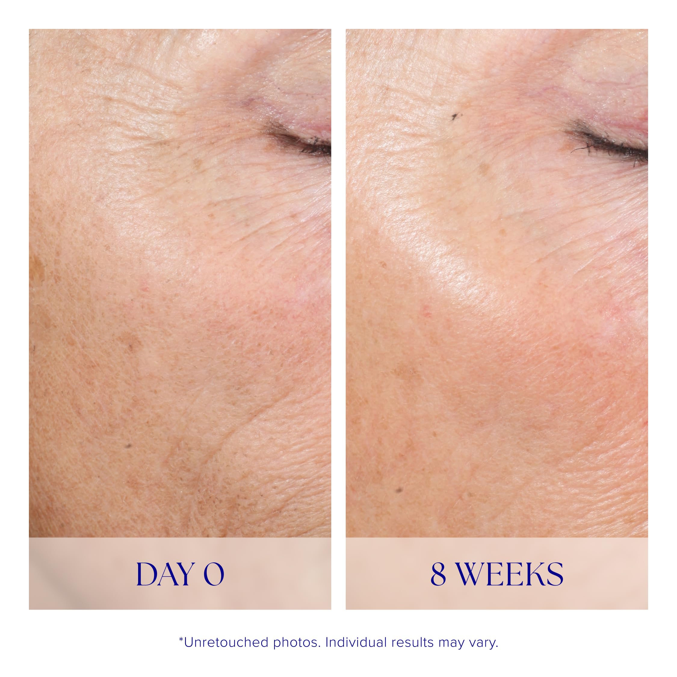 iS CLINICAL application on face demonstrating easy at-home use