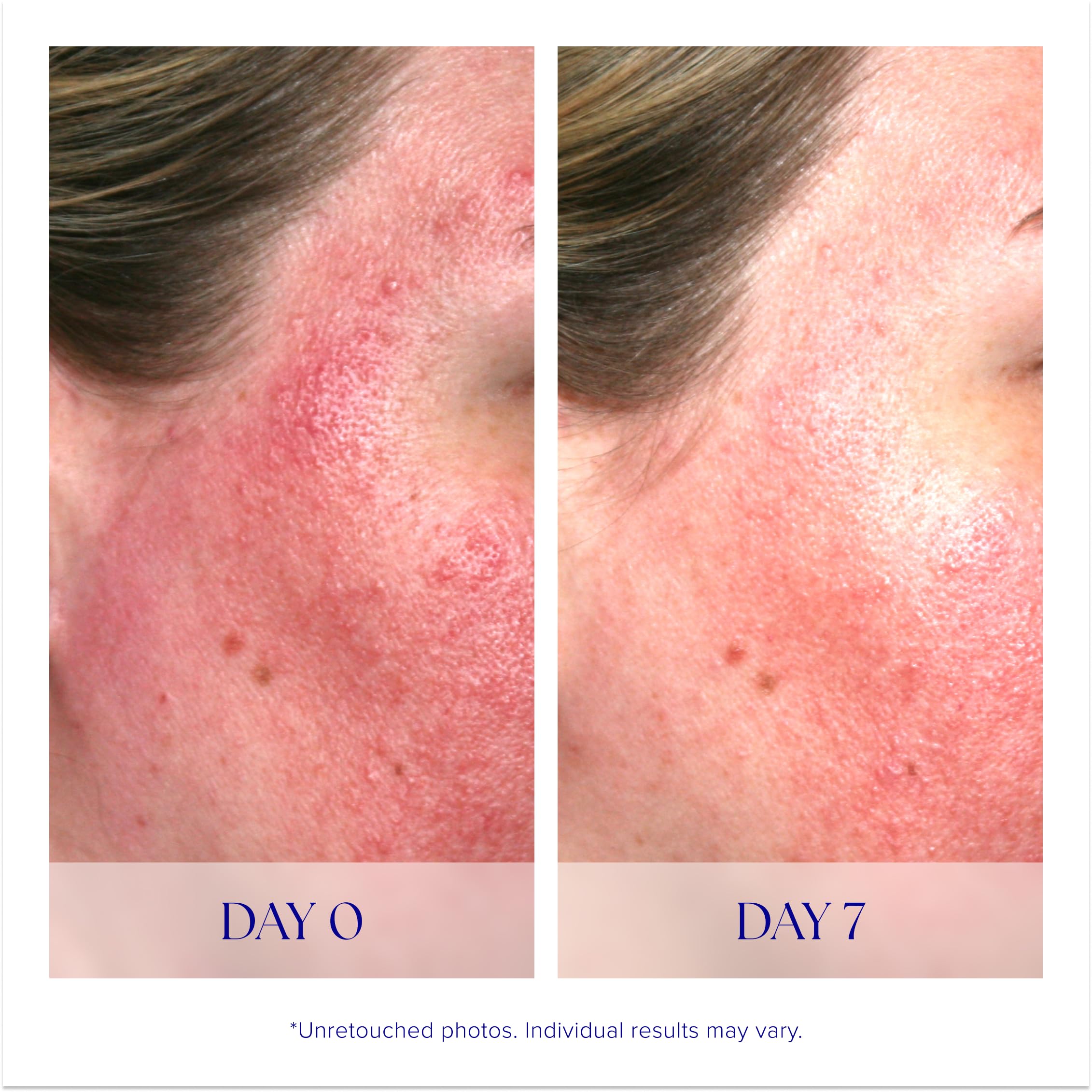 iS CLINICAL Pro-Heal Serum bottle held in hand to show 0.5 fl oz scale and travel-friendly benefit