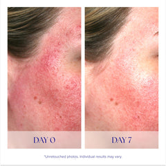 iS CLINICAL Pro-Heal Serum bottle held in hand to show 0.5 fl oz scale and travel-friendly benefit