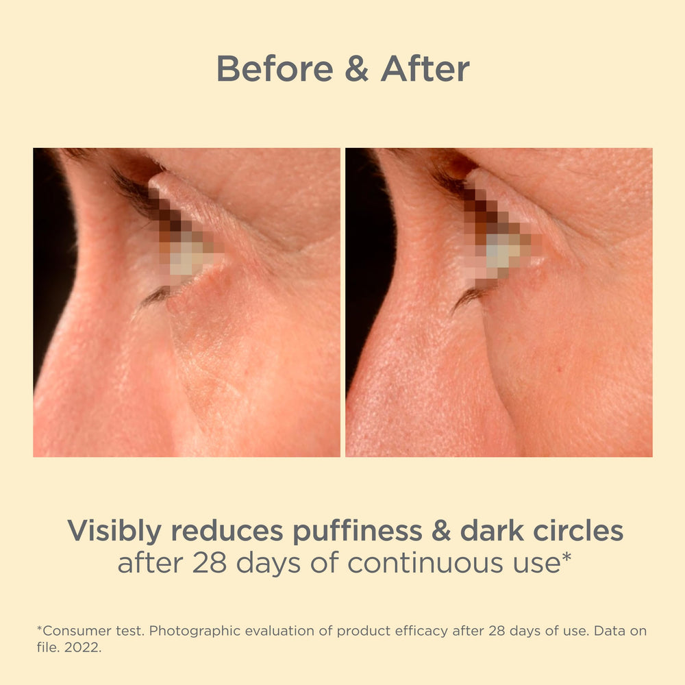 ISDIN before and after under-eye comparison showing brighter skin