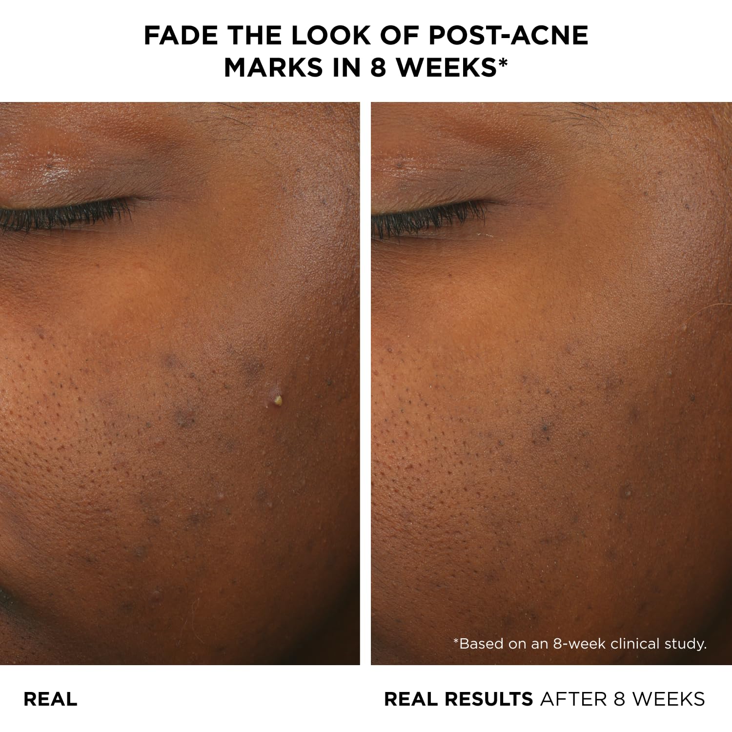 IT Cosmetics serum texture on dropper highlighting lightweight, fast-absorbing formula