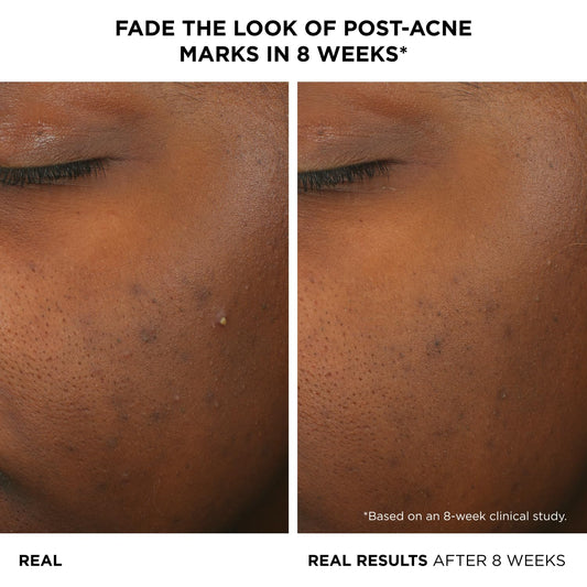 IT Cosmetics serum texture on dropper highlighting lightweight, fast-absorbing formula