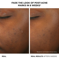 IT Cosmetics serum texture on dropper highlighting lightweight, fast-absorbing formula