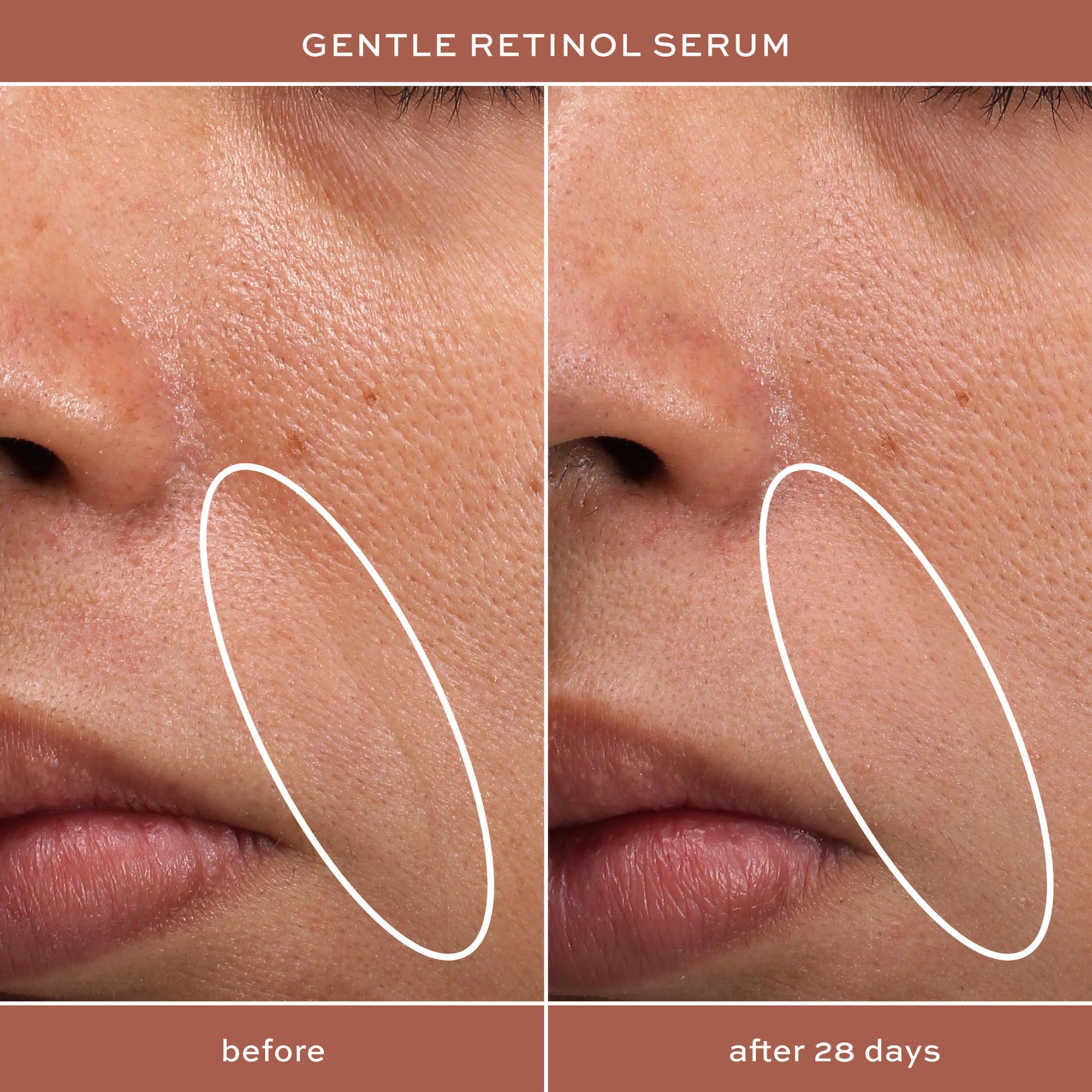 ITK serum in a nighttime routine showing soothing skin benefits