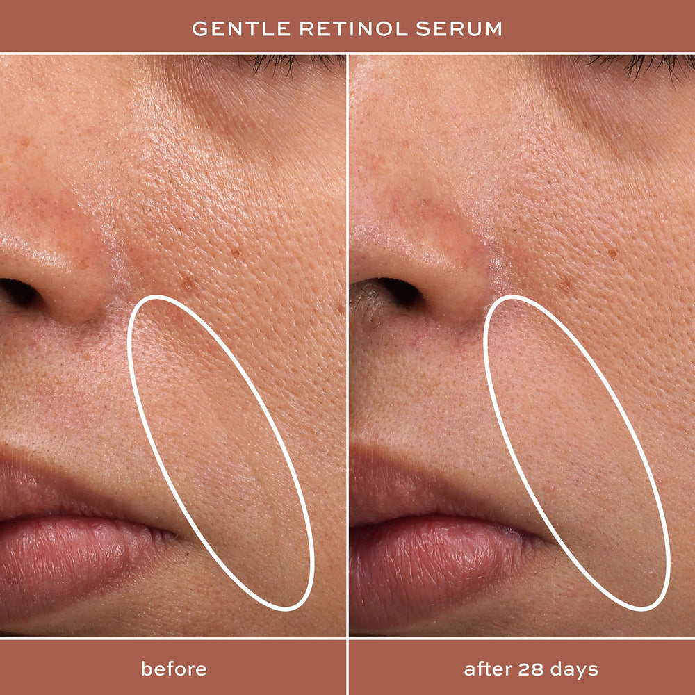 ITK serum in a nighttime routine showing soothing skin benefits