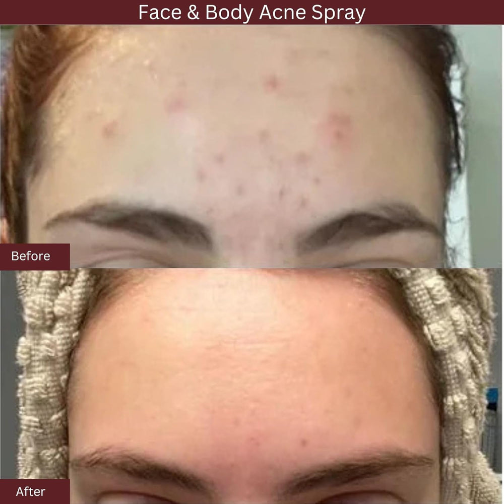 ITK spray being applied to back showing easy reach and convenience