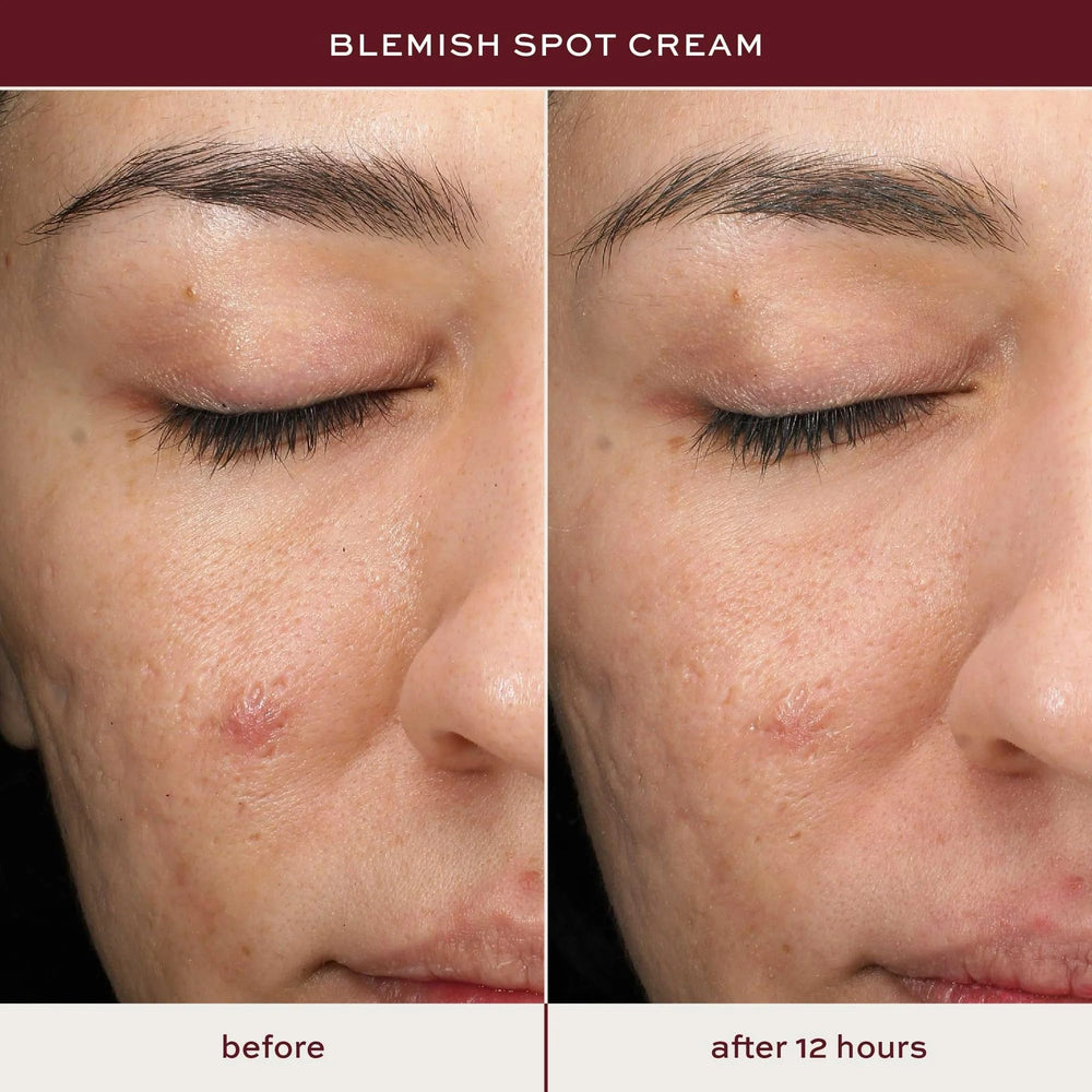 ITK gel texture close-up showing lightweight absorbent formula that reduces shine