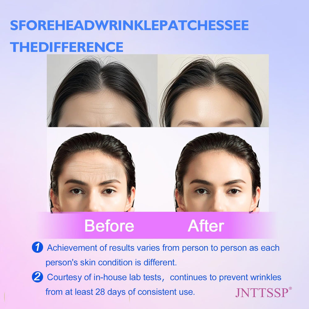 JNTTSSP open case with individual patches visible, illustrating single-use freshness and portability