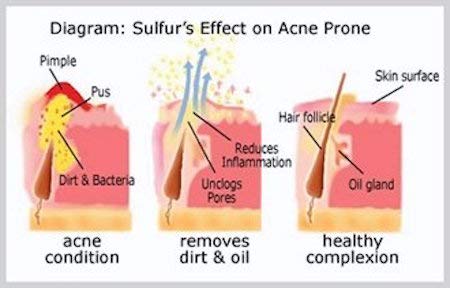 JOESOEF SKIN CARE sulfur powder ingredient shot demonstrating active component