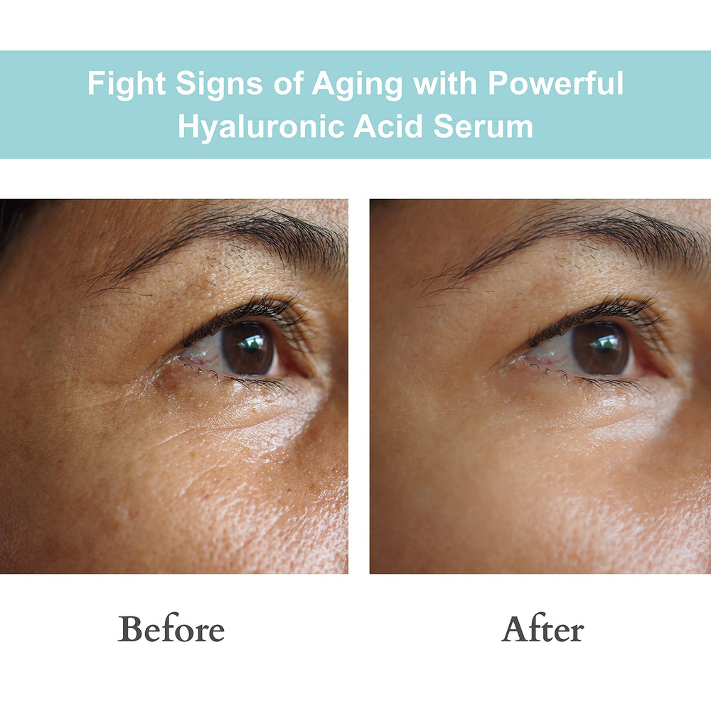 JOYAL BEAUTY ingredient label close-up highlighting dual-weight hyaluronic acids