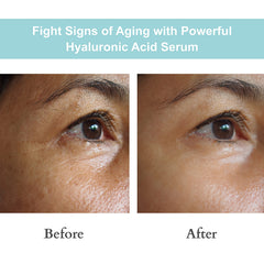 JOYAL BEAUTY ingredient label close-up highlighting dual-weight hyaluronic acids