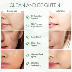 Jtopyrt pads next to skincare bottles in bathroom routine setting