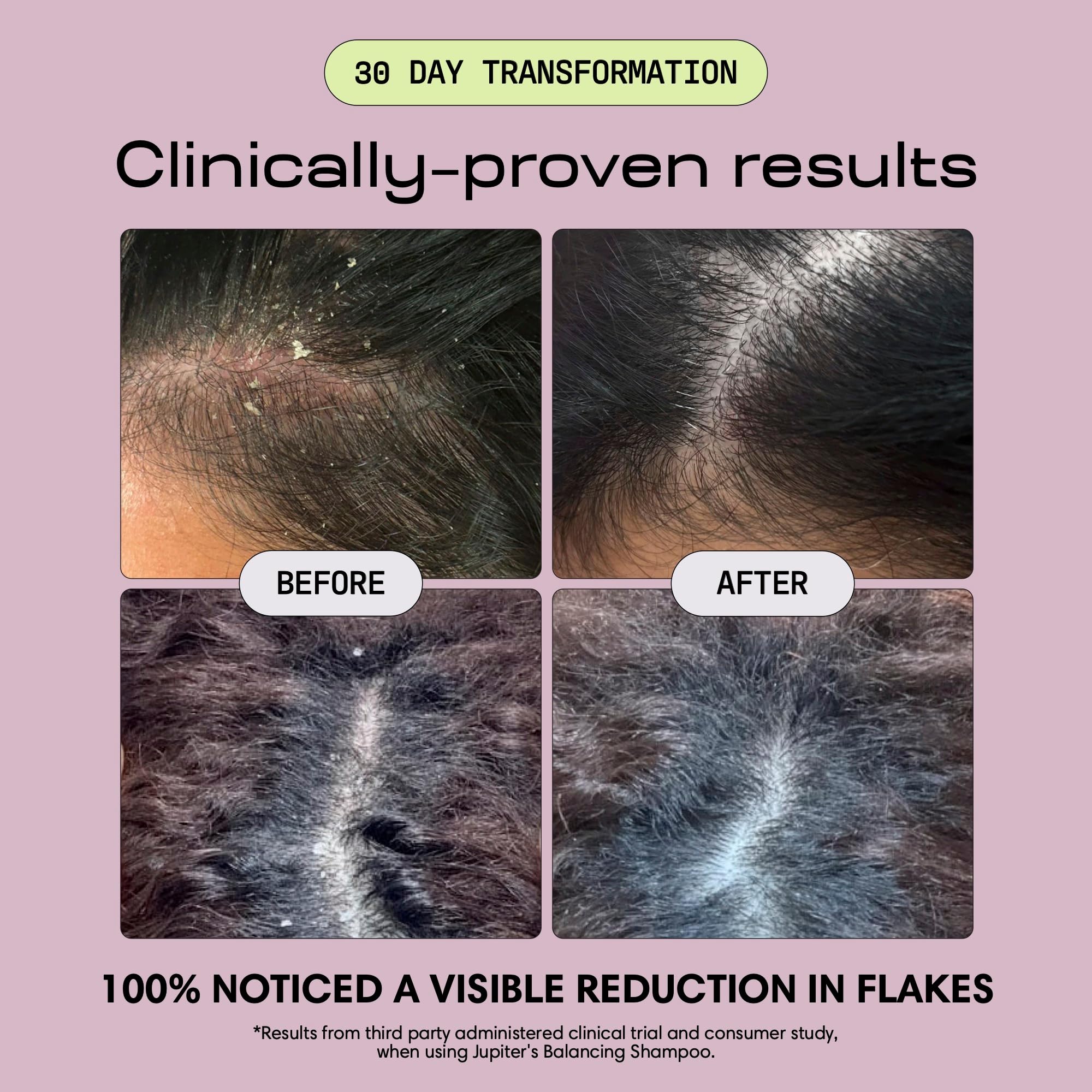 Jupiter restoring serum dropper detail showing concentrated scalp-nourishing dose