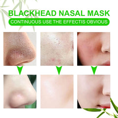 JWBVCTCR used strips with removed blackheads demonstrating effectiveness