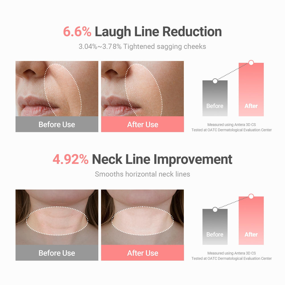 KAHI applying balm under-eye to reduce dryness and smooth fine lines benefit
