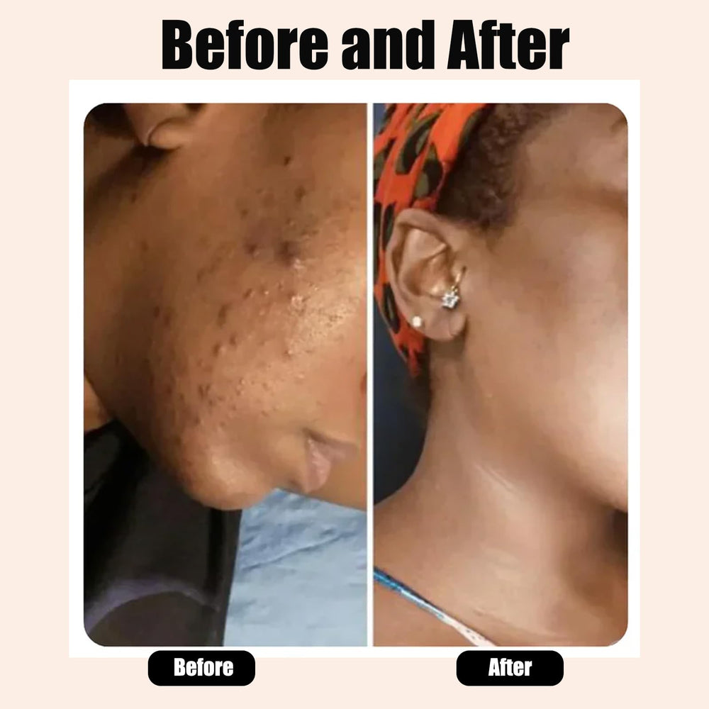 Kalani Glow hair and scalp application showing removal of buildup gently